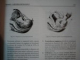 TRATAT DE OBSTETRICA ED. II- a VOL I - II de IOAN MUNTEANU , 2006