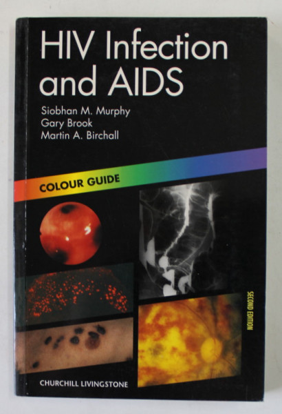 HIV INFECTION AND AIDS by SIOBHAN M. MURPHY ...MARTIN A. BIRCHALL , COLOUR GUIDE , 2000