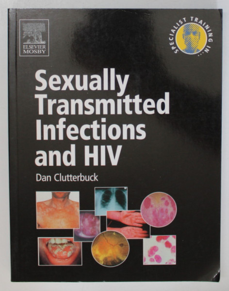 SEXUALLY TRANSMITTED INFECIONS AND HIV by DAN CLUTTERBUCK , 2004