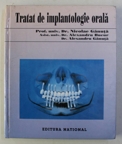 TRATAT DE IMPLANTOLOGIE ORALA - NICOLAE GANUTA,ALEXANDRU BUCUR,ALEXANDRU GANUTA,